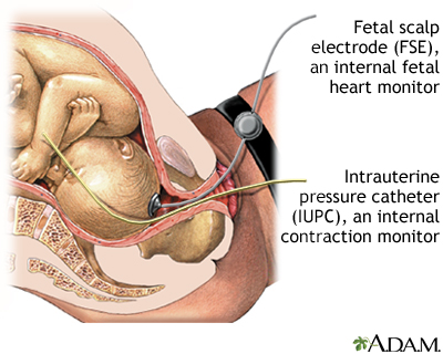 and your contractions.